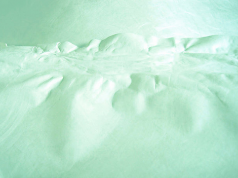 The Art of Losing isn't Hard to Master, Sally Burch