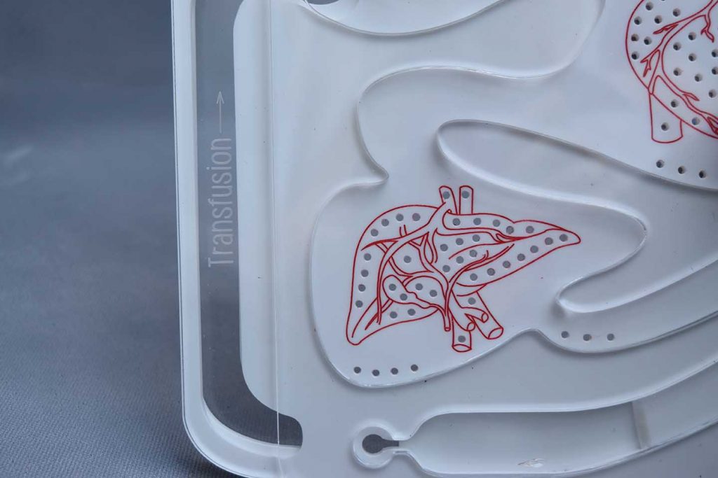 Detail image of Sickle Cell Educational Toy by Grace Pappas and Jonathan Morris for which they jointly received the Harry Crisp Award for community-focused design in 2016.